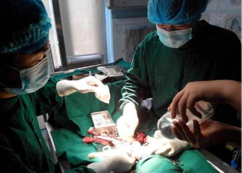 骨髓炎和脊柱炎一样吗,骨髓炎与骨不连的关系