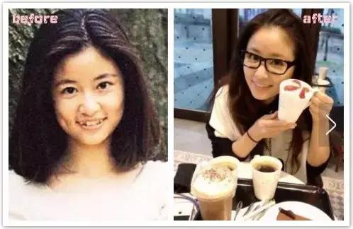 孩子牙齿畸形怎么办,小孩子牙畸形怎么办