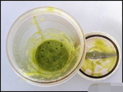 激光去除老年斑要多少钱,男人脸上老年斑去除方法