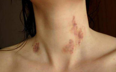 宝宝被年轻妈妈吻后中风丧命，“种草莓”游戏不能乱玩