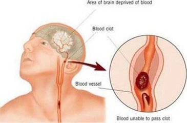 宝宝被年轻妈妈吻后中风丧命，“种草莓”游戏不能乱玩