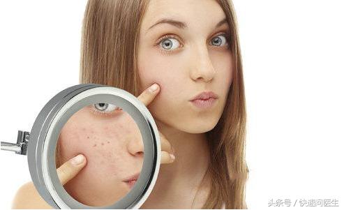 去除暗疮印最好的方法,脸暗疮怎么治疗好得快