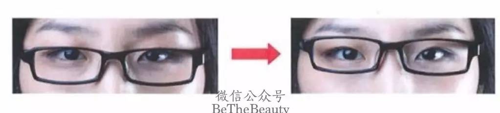 为什么自己不戴眼镜比戴眼镜好看,有人戴眼镜比不戴眼镜好看么