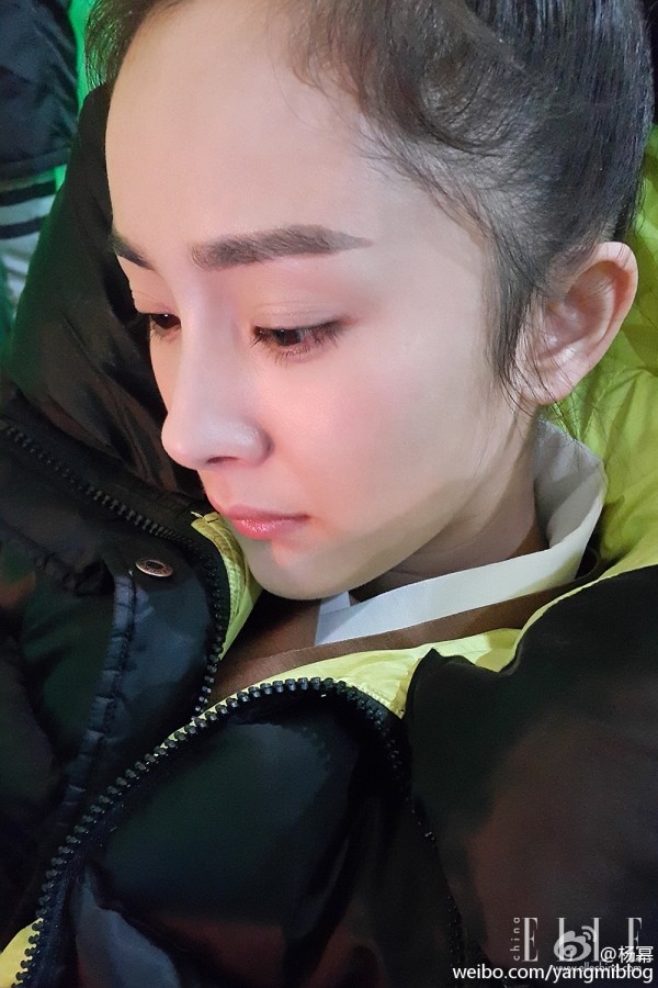 双眼皮100种整形图解,双眼皮整形全程讲解