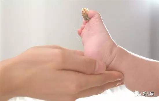 儿科物理降温,医生是怎么给孩子物理降温