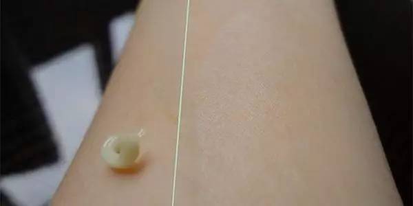 祛痘神器痘痘的克星,和痘痘疯狂抗争的经历