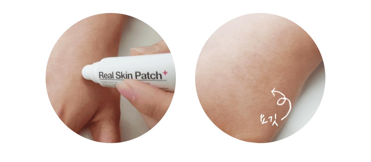 祛痘神器痘痘的克星,和痘痘疯狂抗争的经历