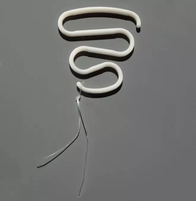 宫内节育器的扭曲历史,宫内节育器移位案例