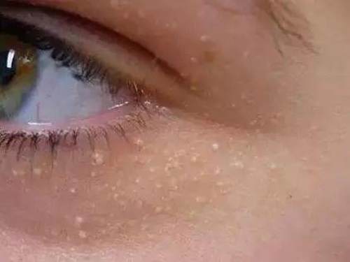 护肤问答每天解决一个小问题,护肤小课堂你知道肌肤也会疲劳吗