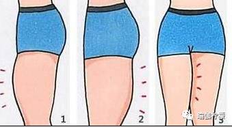 开髋不收髋的危害,怎样开髋最见效