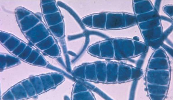 人传染了猫癣还会传染给其他人吗,得了猫癣会烂哪里