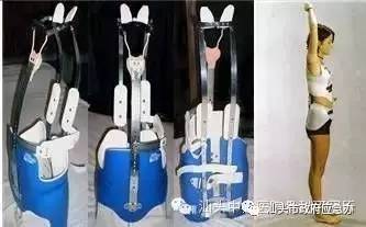 脊柱畸形可以申请补助吗,先天性结构畸形贫困能申请救助吗