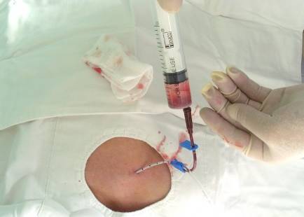 扎管的温度——北京医院肿瘤科护士手记｜有故事的人