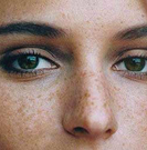 孙思邈除雀斑的方法,孙思邈祛除疤痕千古秘方