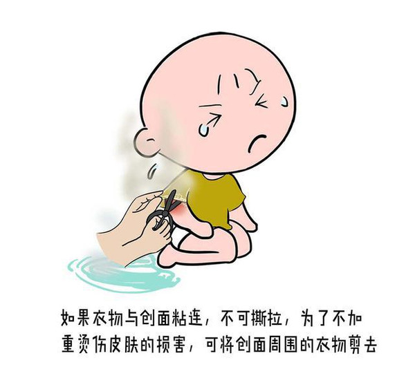 发生意外烫伤后的急救步骤,儿童被水烫伤急救处理办法