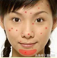 关于痘痘肌肤应该如何护肤,关于痘痘治疗方法