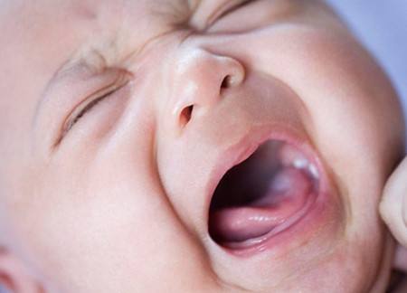 宝宝患上鹅口疮怎么办,宝宝得了鹅口疮的表现是什么