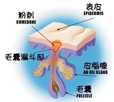 为什么你的毛孔会又黑又大,毛孔粗大怎么办方法其实很简单