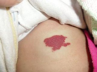 宝宝被年轻妈妈吻后中风丧命，“种草莓”游戏不能乱玩