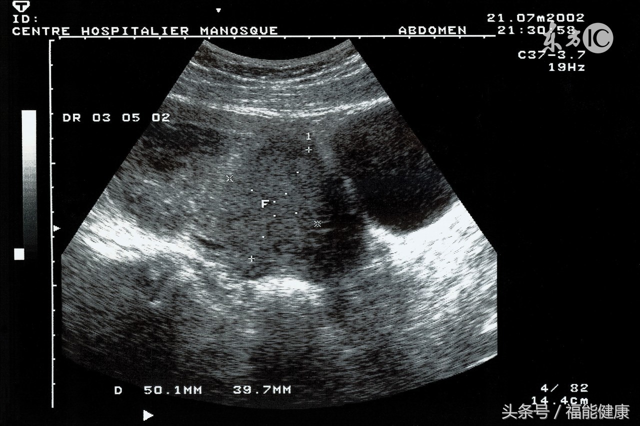 含妇科检查的健康体检,体检怎么摆脱妇科亚健康