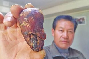 一夜暴富养鸡案例,小伙养鸡有绝招一年净赚上千万