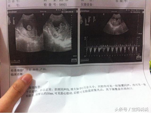 孕妈产检要带什么,孕妈检查表注意事项