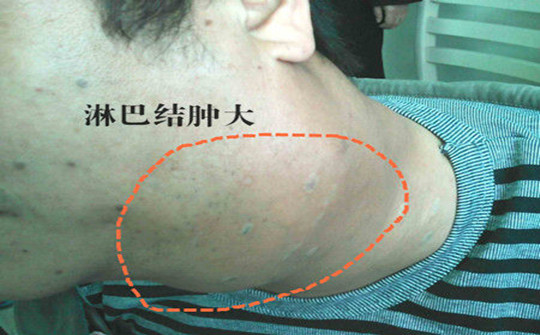 癌症最前沿治疗方法,最快30分钟可治愈多种特定癌症