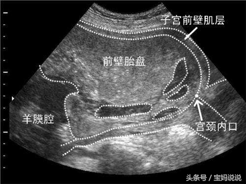 孕妈产检要带什么,孕妈检查表注意事项