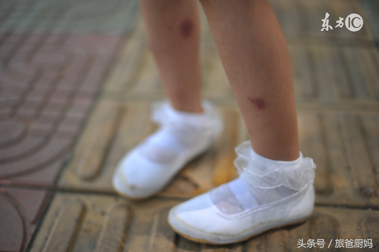 为宝宝驱蚊子,为宝宝驱蚊的办法