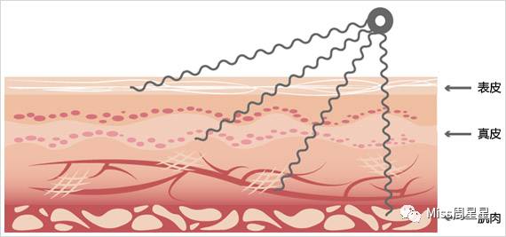 提拉紧致抗衰老美肤仪,提拉紧致美容仪效果最好的