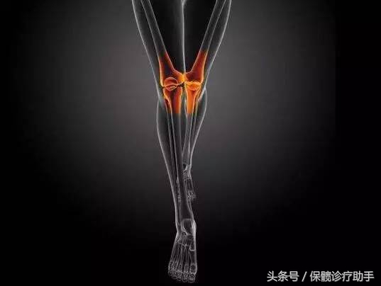 骨坏死与股骨头坏死一样吗,骨坏死和股骨头坏死是一个病吗