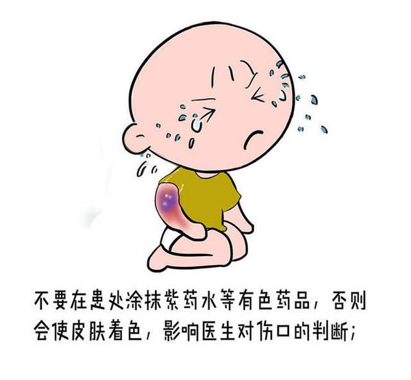 发生意外烫伤后的急救步骤,儿童被水烫伤急救处理办法