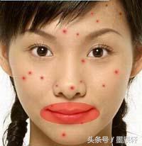 关于痘痘肌肤应该如何护肤,关于痘痘治疗方法