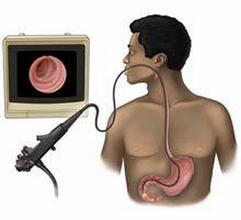 做胃镜很痛苦,有什么办法可以让做胃镜不再受罪?这两个办法好!