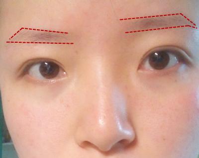 高低眉最好的补救方法,如何正确看待高低眉