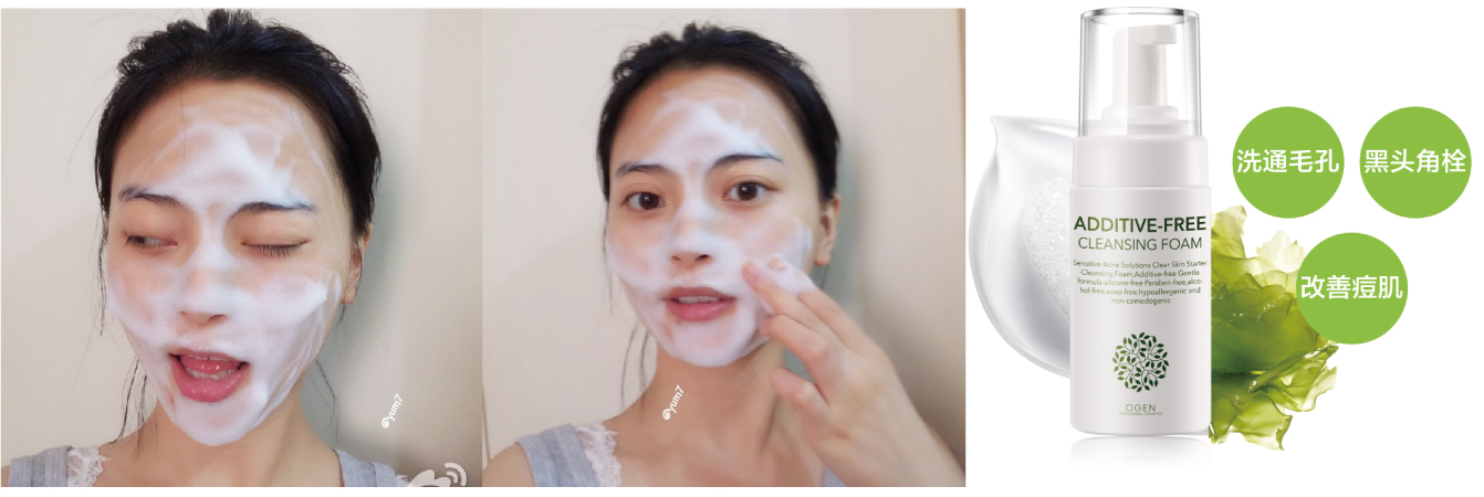 下巴长针眼大小白脓点是怎么回事,下巴有毛毛刺是什么原因