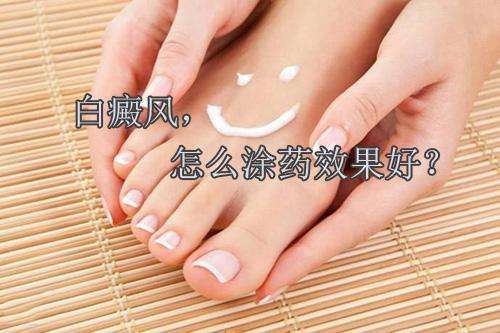 光靠涂药能治好白癜风？医生的回答让我们大吃一惊