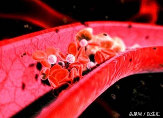 系统性血管炎怎么治才能除根,肾脏血管炎好治吗应该注意什么