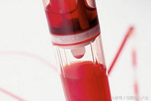 新生儿溶血症一般几天能治愈,新生儿溶血病的发病机制