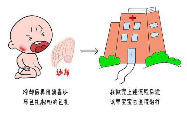 发生意外烫伤后的急救步骤,儿童被水烫伤急救处理办法
