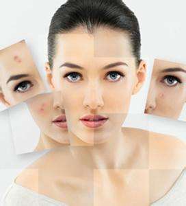 祛痘祛痘印最有效的方法小妙招,如何正确祛痘祛痘印小妙招