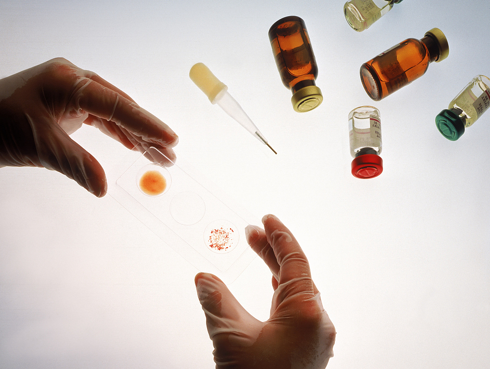 高危后怕得艾滋病有什么阻断药吗,艾滋病高危行为后补救