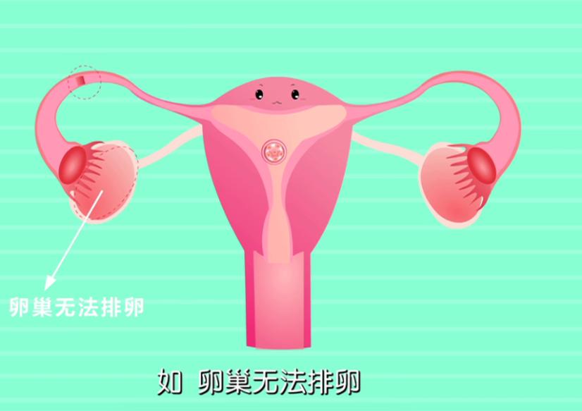 孕检6-8周检查哪些项目,19周孕检做什么检查项目