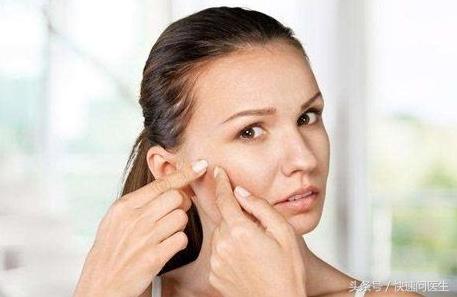 去除暗疮印最好的方法,脸暗疮怎么治疗好得快