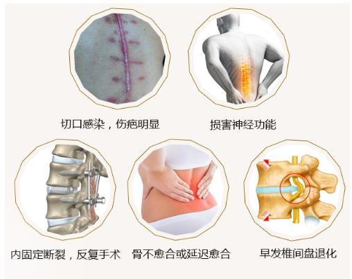 脊柱侧弯治疗最有效最快的办法,脊柱侧弯治疗有几种方法