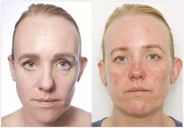 长期不卸妆会怎么样,不卸妆的危害有多大