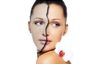 夏日不做斑点美人，一定要皮肤无瑕疵！