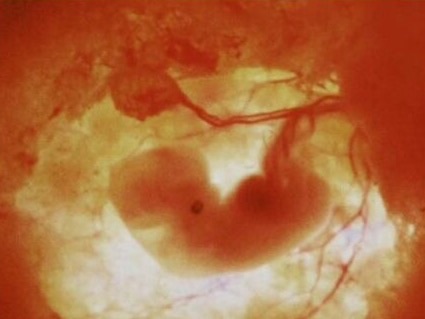 准妈妈怀孕早期的孕程须知