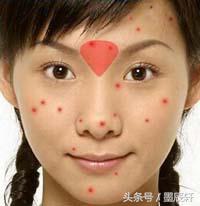 关于痘痘肌肤应该如何护肤,关于痘痘治疗方法