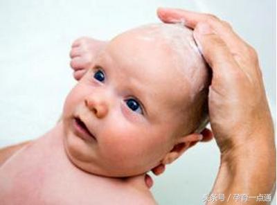 婴儿头上长乳痂反反复复要怎么办,婴儿乳痂掉了头皮红肿怎么办